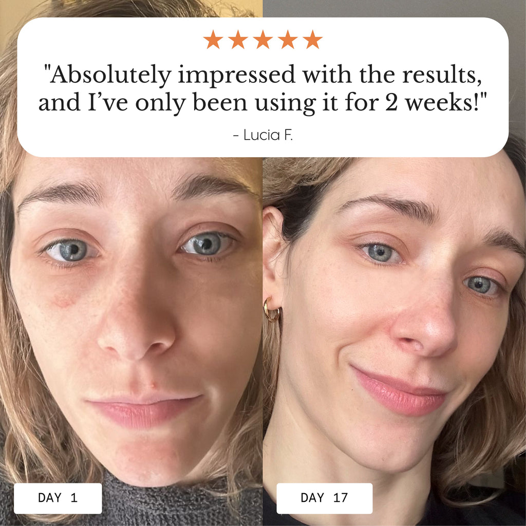 Hyper Potent Dark Circles & Bag Eye Balm