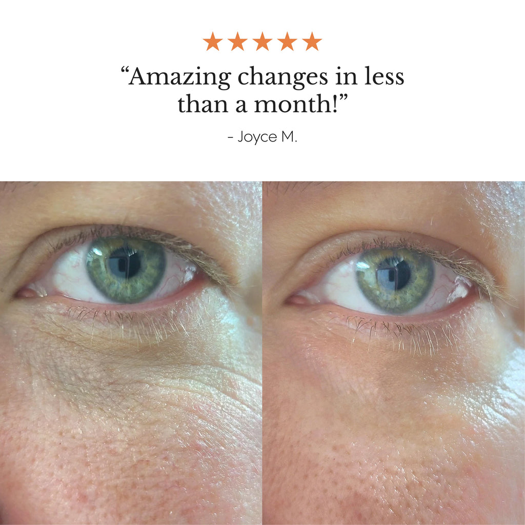 Hyper Potent Dark Circles & Bag Eye Balm