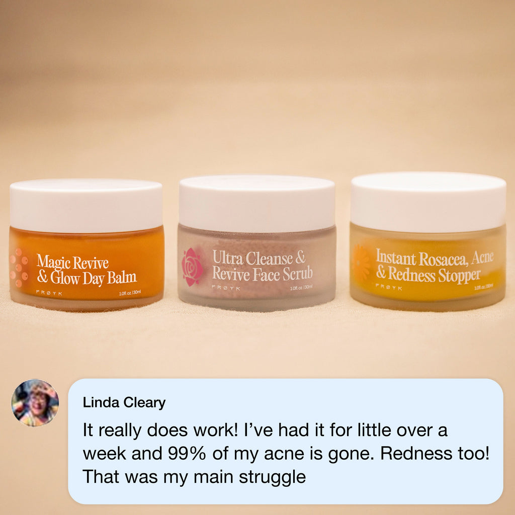 The Complete Acne System for Women